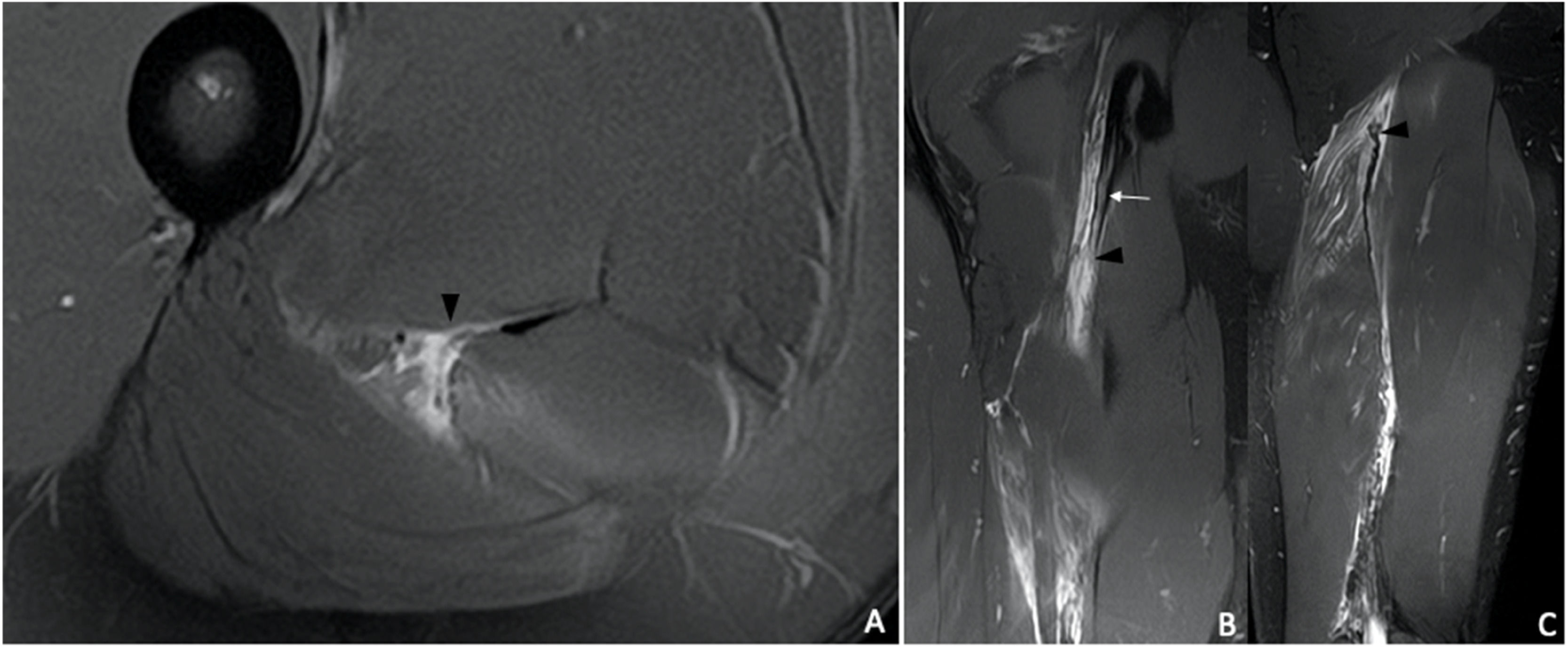 fig0001