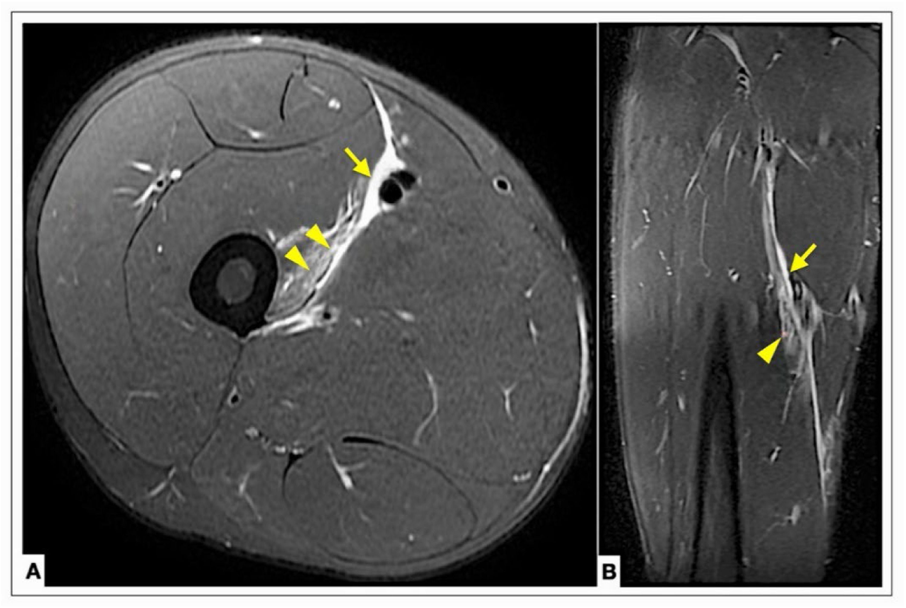 fig0002
