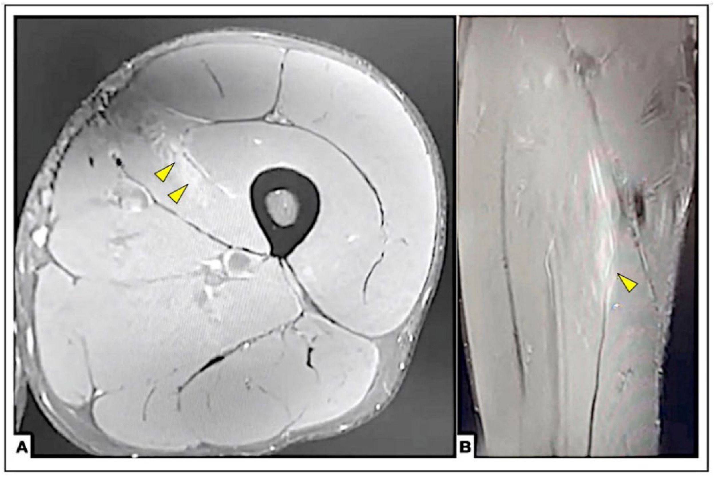 fig0005