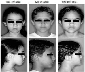 Facial profiles12.