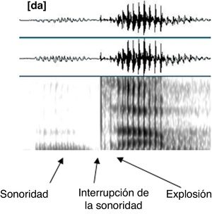 Ilustración de las interrupciones de la sonoridad en las consonantes sonoras.