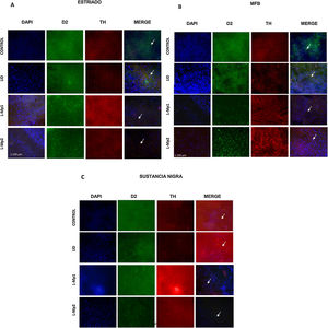 Inmunofluorescencia de cada grupo con triple marcaje: DAPI, tirosina hidroxilasa (TH) y el marcador RD2 para cada una de las zonas de estudio. A. Estriado (ST) B. Haz medial del cerebro anterior (CAM). C. Sustancia nigra pars compacta (SNpc). *Las flechas indican las células con triple marcaje (neuronas dopaminérgicas con la expresión del receptor D2).