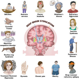 Main neurological diseases and other pathologies treated with deep brain stimulation.