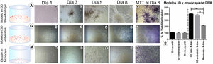 Cell culture models: Three-dimensional (3D) and monolayer cultures of glioblastoma multiforme (GBM) cells, with 5000 cells/well on a 96-well plate; cell growth was monitored for 8 days. A) 3D Matrigel base layer culture of GBM cells. B–E) Photomicrographs of the 3D Matrigel base layer culture at different stages of development, with cells visible on the surface. F) MTT results on day 8. G) 3D Matrigel-embedded culture of GBM cells. H–K) Photomicrographs of the 3D Matrigel-embedded cell culture. L) MTT results on day 8. M) Monolayer cell culture. N–Q) Photomicrographs of the monolayer cell culture. R) MTT results on day 8. Images D, E, F, P, and R are shown at 20× magnification; the remaining images are shown at 10× magnification. S) Chart showing the percentage of viable cells at 8 days for the different GBM cell cultures (3D Matrigel base layer and Matrigel-embedded cell cultures, and monolayer cell culture) compared to the initial number of cells (5000 per well at 6 h). The 6-h cultures represent the number of cells used at the beginning of the study; the percentage of growth in each culture was compared after 8 days. Data are expressed as mean (SD) with differences significant at P < .005 (one-way ANOVA) versus the control group.