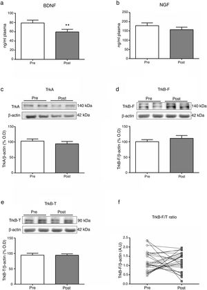 Mean differences (SD; univariate analysis) on biomarkers at baseline (Pre) and two hours after (Post) a single electroconvulsive session. BDNF and NGF plasma levels (a, b); Protein expression of TrkA, TrkB-F and TrkB-T in PBMC (c-e); Ratio of TrkB-F/TrkB-T expression (f). BDNF: Brain-derived neurotrophic factor; NGF: Nerve growth factor; PBMC: Peripheral blood mononuclear cells; TrkA: Tyrosine kinase-type A receptor; TrkB-F: Full-length form of the tyrosine kinase-type B receptor; TrkB-T: Truncated-length form of the tyrosine kinase-type B receptor.