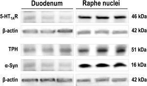 Images of Western blot of 5-HT1AR, tryptophan hydroxylase (TPH), and monomeric α-Syn protein in duodenum and raphe nuclei lysates from the same wild-type mice (n=3). For detection, immunoblots for 5-HT1AR, TPH, and α-Syn were performed using different antibodies against: 5-HT1AR (Ref: ab85615; 1:2000), TPH1/2 (Ref: AB1541, 1:1000), and mouse and human α-Syn (Ref: ab212184; 1:1000). β-Actin used as loading control (Ref: A3854; 1:50,000).