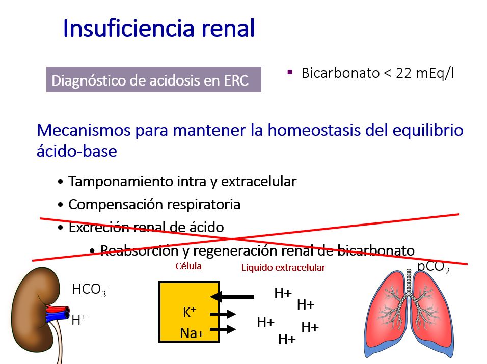 En la insuficiencia renal están alterados los mecanismos de excreción renal de ácido y de reabsorción y regeneración renal de bicarbonato.