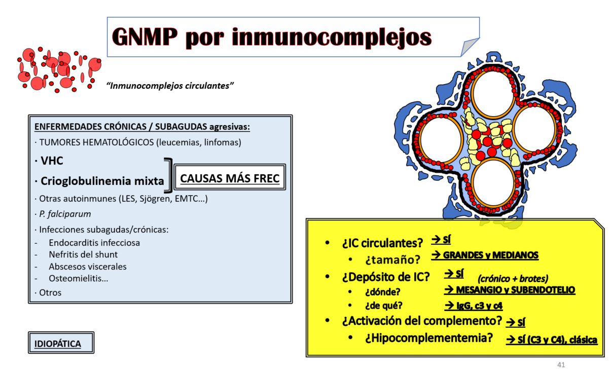 En las GN por inmunocomplejos suele existir una patología crónica asociada a una producción constante de inmunocomplejos: infecciones crónicas, tumores hematológicos o enfermedades autoinmunes. En estas patologías hay tantos inmunocomplejos que exceden la capacidad del sistema inmune para eliminarlos de la circulación, y acaban depositándose en el glomérulo. En este caso los inmunocomplejos se depositan en el mesangio glomerular y en las paredes capilares (mesangiocapilar), concretamente subendoteliales (no atraviesan la membrana basal). 
Las principales causas de GNMP por inmunocomplejos son:

Infección crónica por el VHC
Crioglobulinemia mixta (la mayoría asociada a VHC)
Gammapatías monoclonales (síndromes linfoproliferativos)
Patologías autoinmunes (lupus, Sjögren, enfermedad mixta del tejido conectivo)
Infecciones bacterianas subagudas o crónicas: endocarditis infecciosa, osteomielitis, abscesos viscerales, nefritis del shunt (asociada a la infección de derivaciones de LCR)
Infecciones parasitarias crónicas (plasmodium falciparum)

La GNMC idiopática es un diagnóstico de exclusión cuando no se encuentra la etiología.
 
Etiopatogenia: según la teoría de la localización de los depósitos según el tamaño de los inmunocomplejos, en estas situaciones de producción crónica de ICs existe un depósito constante de inmunocomplejos de gran tamaño (gran proporción de anticuerpos respecto al antígeno) en el mesangio, y en las situaciones en las que la enfermedad se agudiza (reactivaciones del VHC, brotes de crioglobulinemia, etc) existe mayor producción de antígenos y el tamaño de los inmunocomplejos será más pequeño (al existir más antígenos en relación con los anticuerpos) que se depositan a nivel subendotelial, dando lugar a depósitos alrededor de las asas capilares que son englobados por membrana basal dando aspecto de ¿doble contorno de la membrana basal¿ o depósitos masivos subendoteliales en ¿asas de alambre¿ o donuts.
Las claves para reconocer esta GN son:

Presencia de inmunocomplejos circulantes
Depósito de inmunocomplejos (grandes) mesangiales y (medianos) subendoteliales
Activación del complemento por vía clásica

Hipocomplementemia de c3 y c4
Depósitos de C3, C4, C1q



