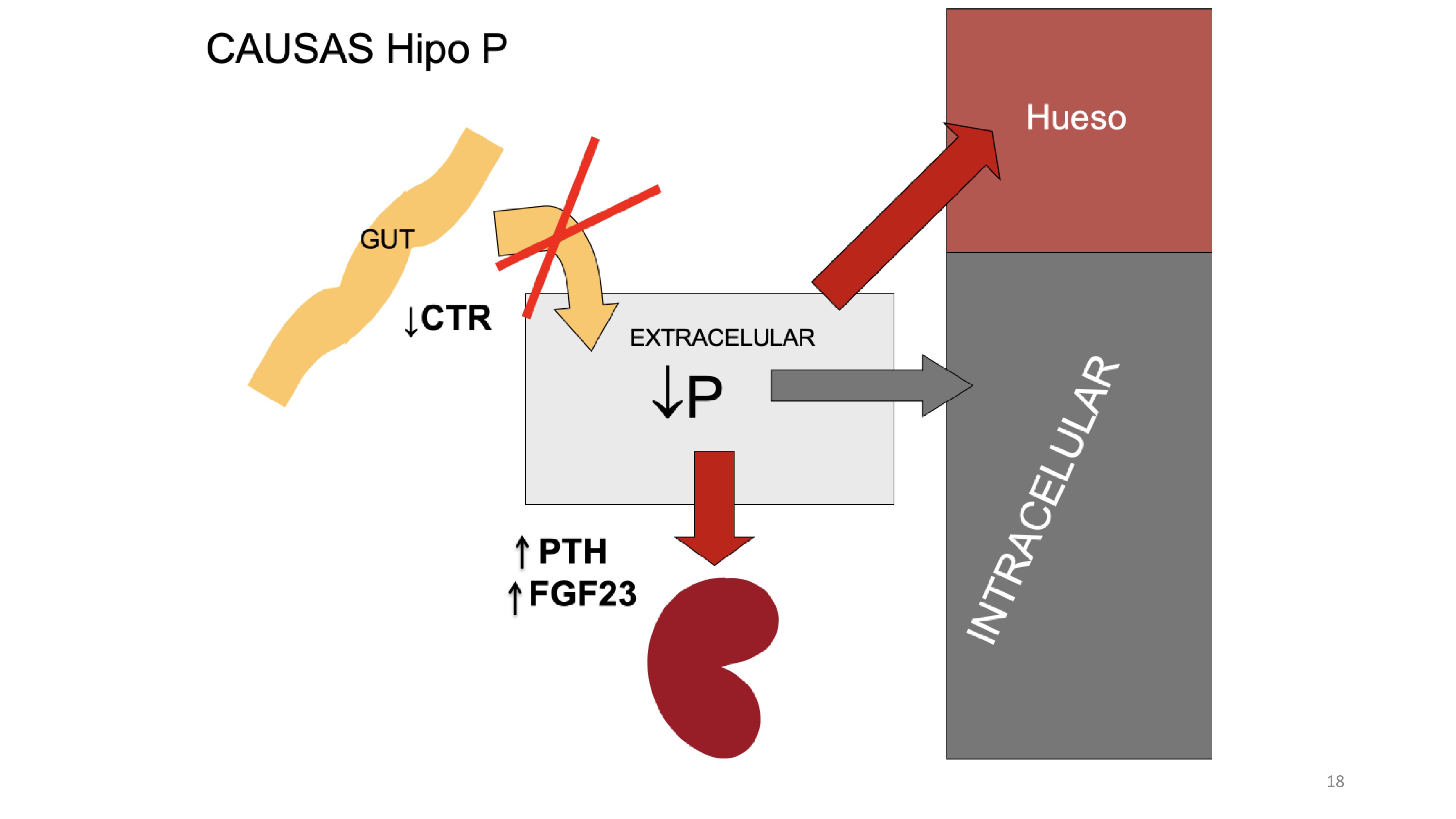 La concentración de P sérico ( valores normales fosfato sérico (P) son de 3 a 4,5 mg/dl (0,75-1,45 mmol/l) en niños los valores normales legan hasta 5-6 mg/dl depende de la edad . La concentración de P en el suero refleja el contenido de P extracelular que es el resultado del balance de absorción intestinal de P , intercambio cpn hueso y células y excreción renal de PLas causas de hipofosfatemia se pueden esencialmente: -disminución de absorción intestinal de P (falta de vitamina D)-desplazamiento de P al hueso o espacio intracelular (aumento del pH)-excesiva excreción renal de P (que es estimulada oor FGF23 y por PTH)