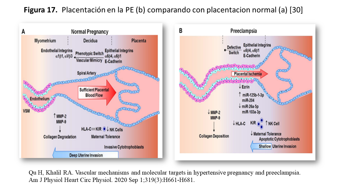 Efecto de la Metformina en la hipertrofia ventricular izquierda Estudio  MET-REMODEL